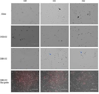 Human dental pulp stem cells modulate pro-inflammatory macrophages both through cell-to-cell contact and paracrine signaling